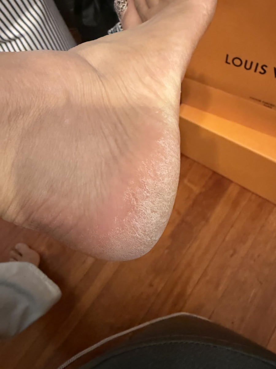 Before using the product