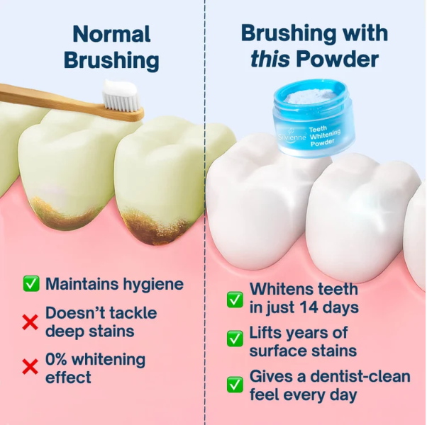 Normal brushing compared with brushing with whitening powder