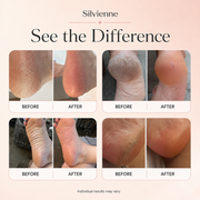 Examples of smoother-looking feet after using an electric foot smoother; individual results may vary
